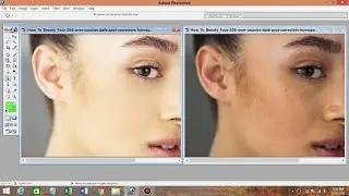 Removing Dark Spot, Circles Quickly in adobe photoshop 7.0 | photo editing face cleaning|