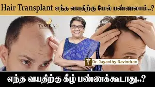 எந்த வயதில் ஹேர் ட்ரான்ஸ்பிளான்ட் செய்து கொள்ளலாம்!