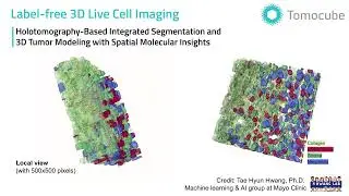Holotomography-based integrated segmentation and 3D tumor modeling