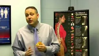 Treatment for Pinched Nerve in the Back