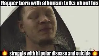RAPPER BORN WITH ALBINISM - Malakai The Truth
