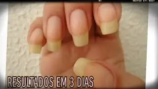 COMO FAZER A UNHA CRESCER EM 3 DIAS