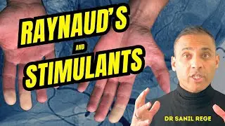Stimulants and Raynaud's: Understanding and Managing the Connection in ADHD Treatment