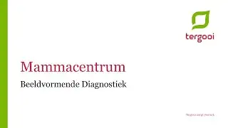 Mammacentrum van Tergooi: beeldvormende diagnostiek door radioloog Esteban van Keulen