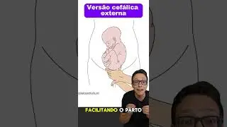 Versão Cefálica Externa  
