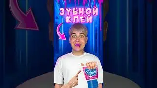 ЗУБНОЙ КЛЕЙ VS ЗЛОЙ ДРУГ! #нонале