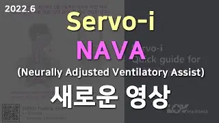 NAVA(Neurally Adjusted Ventilatory Assist) Servo-i 는 이 영상을 참고해주세요.