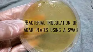 Bacterial Inoculation of Agar Plates Using Swab
