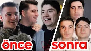ESTETİK YAPTIRDIK! / DEĞİŞİME İNANAMAYACAKSINIZ!