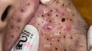 𝐄𝐧𝐣𝐨𝐲 𝐭𝐡𝐞 𝐬𝐮𝐫𝐩𝐫𝐢𝐬𝐞 𝐟𝐫𝐨𝐦 𝐋𝐨𝐚𝐧𝐍𝐠𝐮𝐲𝐞𝐧 #56182733