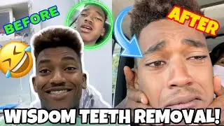 I GOT ALL 4 OF MY WISDOM TEETH REMOVED!