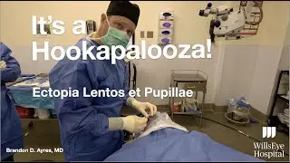 Hookapalooza!  Removal of cataract in patient with Ectopia Lentis et Pupillae