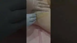 Депиляция сахарной пастой #шугаринг #шугарингобучение #депиляция