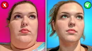 How Facial Fat Defines Your Attractiveness! Effective Tips to Lose Face Fat