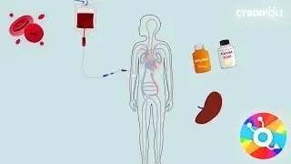 Sferocytose - Behandeling