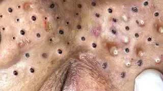 تلميع وتنظيف الجلد الطبيعي المدور 1413594