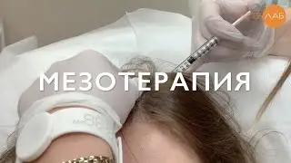 Мезотерапия лечение выпадения волос