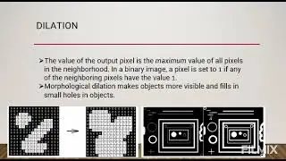 Boundary Detection in an image with MATLAB code