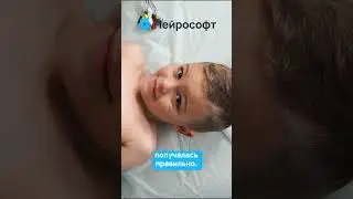 Наложение ЭКГ-электродов #ЭКГ #Нейрософт