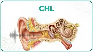 Conductive Hearing loss 🦻🔊: ENT Lecture