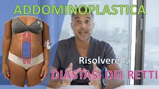 ADDOMINOPLASTICA - Risolvere la DIASTASI dei RETTI