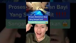 The process of giving birth to a baby is very difficult ‼️ Very surprising ⚠️😱 