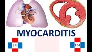 Myocarditis | Diseases of Myocardium | Cardiology Lecture-5