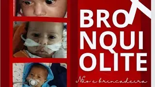 Bronquiolite Não e Brincadeira
