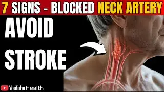 7 WARNING Signs of BLOCKED Arteries in Your NECK