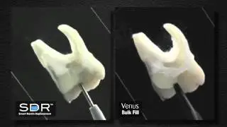 SDR_CompVenus.avi