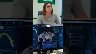 Caso Clinico - Iuxta 3D