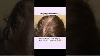 Conquer Oily Scalp |  Your Ultimate  hair Care routine For Hair Growth ✨ #haircare