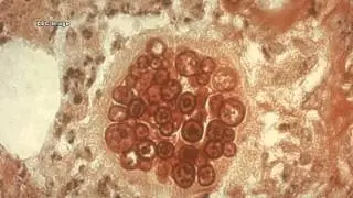 Fungal Pathogens: Part 1 of 2