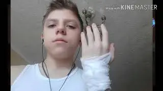 Я  после операции!
