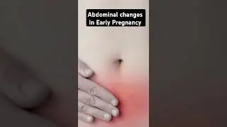 गर्भावस्था के शुरुआती लक्षण हिंदी में #pregnancy #earlypregancy #earlypregnancysymptoms #shortsfeed