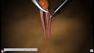 Basic Skills_2018: Fine Dissection