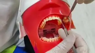 Scaling Teeth Manual & Type Of Rest شرح بالتفصيل