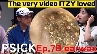 Ep. 78 Earwax removal (Korean ENT doctor “King of earwax”) 귀지형의 Ep.78 귀지제거