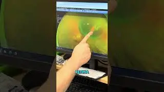 Optos machine's take pictures of the optic nerve and the retina. #drdorioeyecare #eyecare