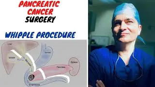UNDERSTANDING WHIPPLE PROCEDURE