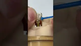 Ceramic with 14 kt gold facing