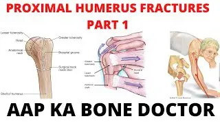 PROXIMAL HUMERUS FRACTURES - PART 1, EPISODE 9