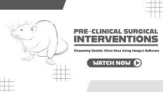 Measuring Stomach Ulcer Area with ImageJ Software
