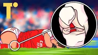 Why do women suffer more ACL injuries than men?