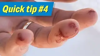 Is Your First Aid Kit Stocked and Ready for Boating Season?