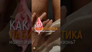ЛАБИОПЛАСТИКА МОЖЕТ ИЗМЕНИТЬ ИНТИМНУЮ ЖИЗНЬ И ИЗБАВИТЬ ОТ КОМПЛЕКСА!