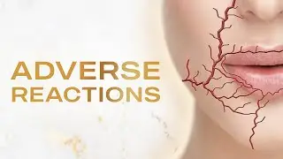 Lip Filler's Adverse Reactions - with Dawn Mougel FNP