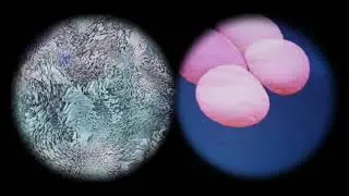 Alien Life in the Telescope