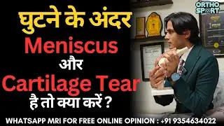 घुटने के अंदर Meniscus और Cartilage Tear है तो क्या करें ? #meniscustear #cartilagetear