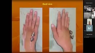 Заседание HANDCLAB в Центре Илизарова